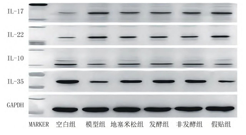 空白組和支氣管哮喘各組大鼠肺組織中IL－17、IL－22、IL－10、IL－35蛋白表達電泳圖